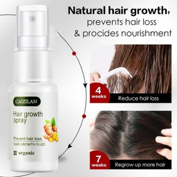 20 мл Джинджифил растежа на косата спрей етерично масло косопад Течен растежа на косата спрей за мъже, жени, грижа за косата