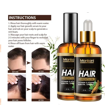 Миноксидил 5 Манкани 100 мл натурален билков етерично масло за растежа на косата Джинджифил наново поникналите косми на косата серум за Лечение на косопад