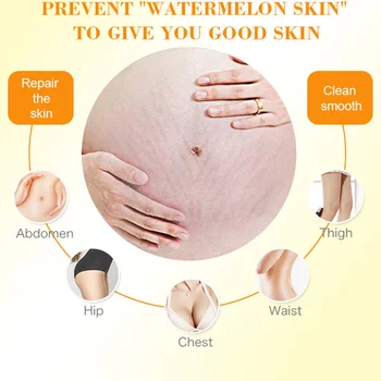 Stretch Mark Pregnancy Scar Repair Remover Skin Body Care Cream MH88