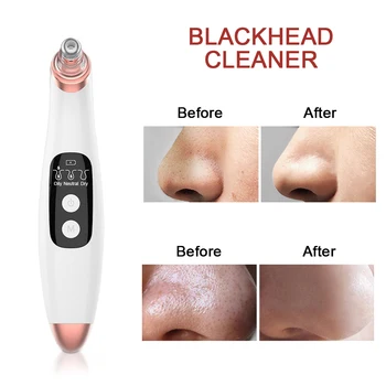 Blackhead Отстраняване Vacuum Pore Cleaner Face Ствие Pimple Skin Removal Scrubber Намалява Бръчките Лифтинг На Лице Nano Лицето Sprayer